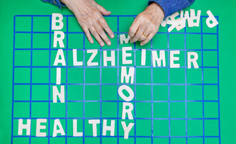alzheimer dementia